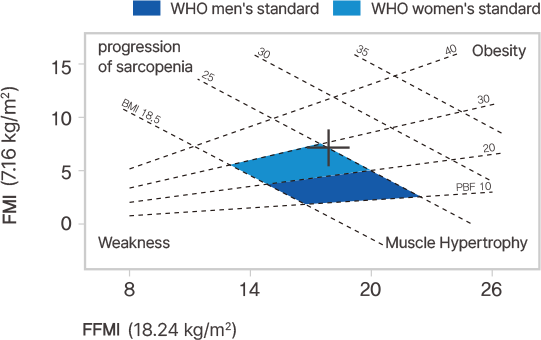 Modrý graf na čiernom pozadí znázorňuje hodnoty FFM a FFM/ (18,24 kg/m²), marker „Muscle Hypertrphy“, oblasti „Weakness“ a „Obesity“.